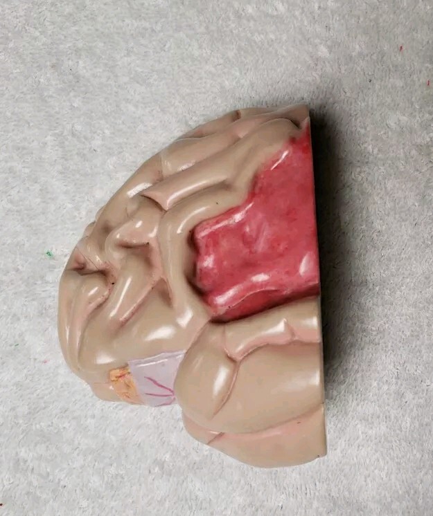 GPI Brain/ Partial Skull Model