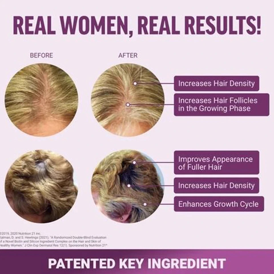 Force Factor Hair Growth Gummies - Supports hair growth and nourishes hair