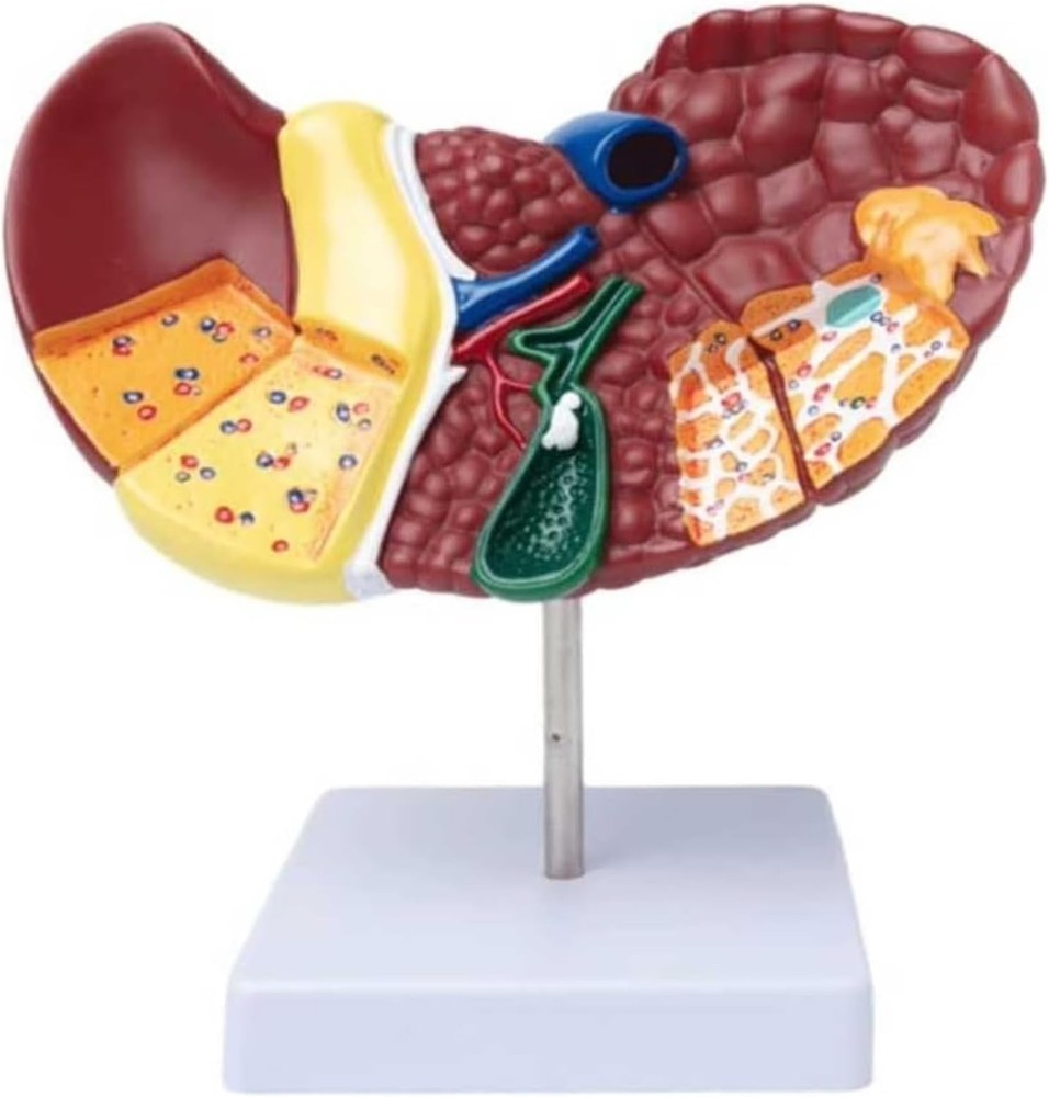 Pathological Liver Anatomical Model 1:1 Human Liver Model Anatomy Display Study