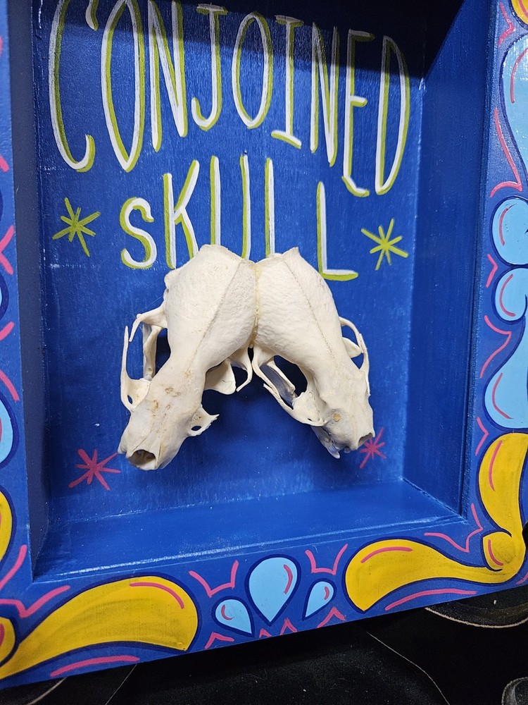 Conjoined Skull Display. Museum Quality, SIDESHOW GAFF, ODDITY, Deformed, Odd