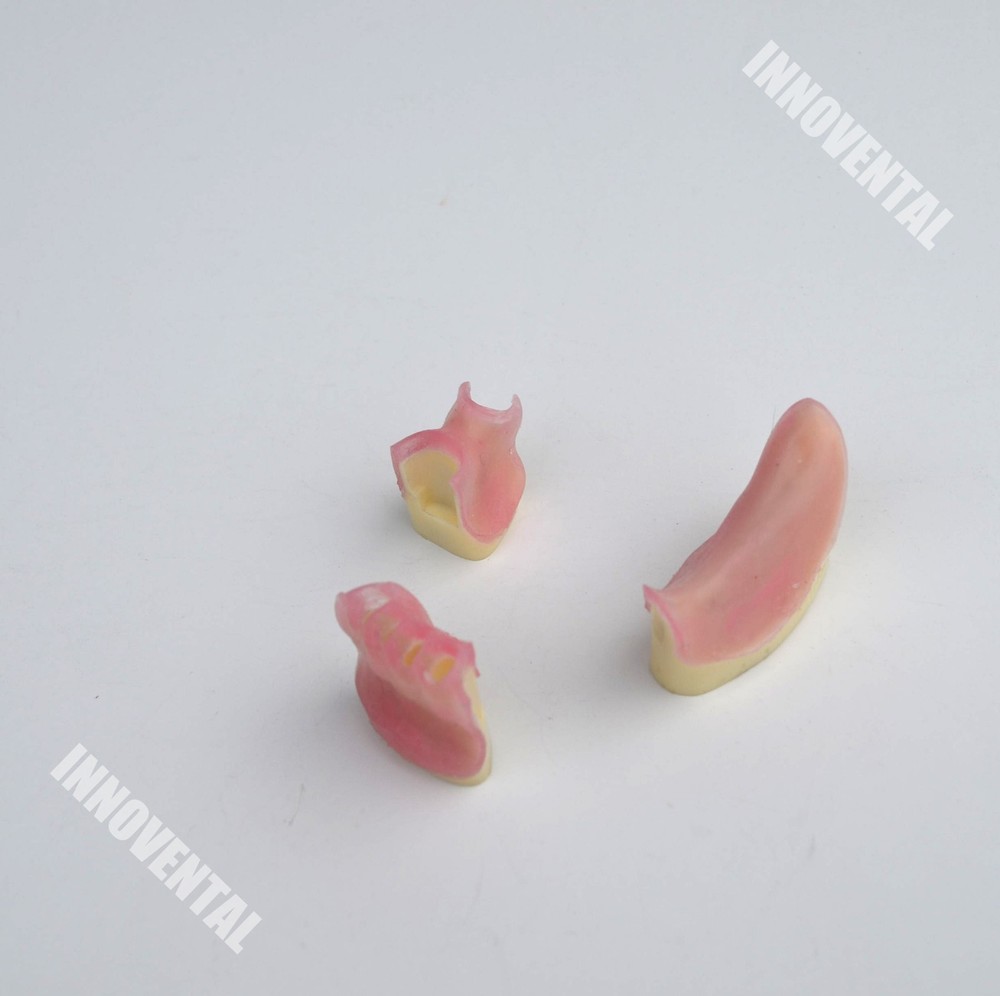 Dental Model #2003 06 - Replaceable Bone Modules for #2003 01