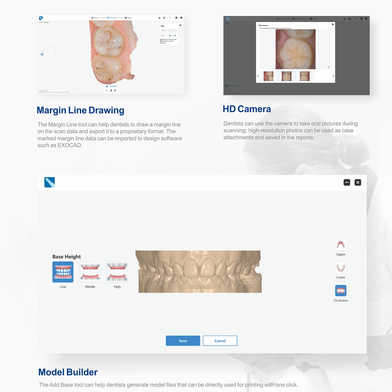 Dental Intra-oral 3D Scanner AI 3D Aoralscan with Free Software