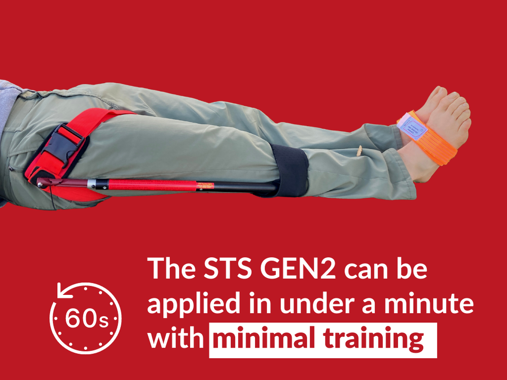 Slishman Traction Splint (STS) - Gen 2
