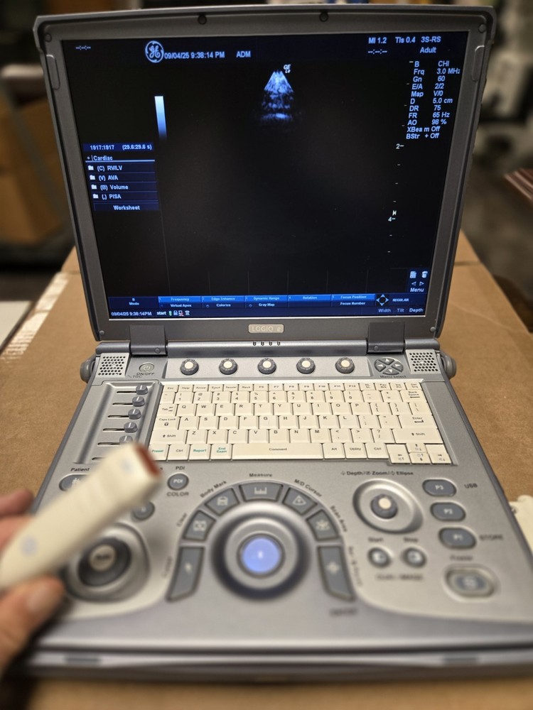 GE Logiq E Portable Ultrasound System