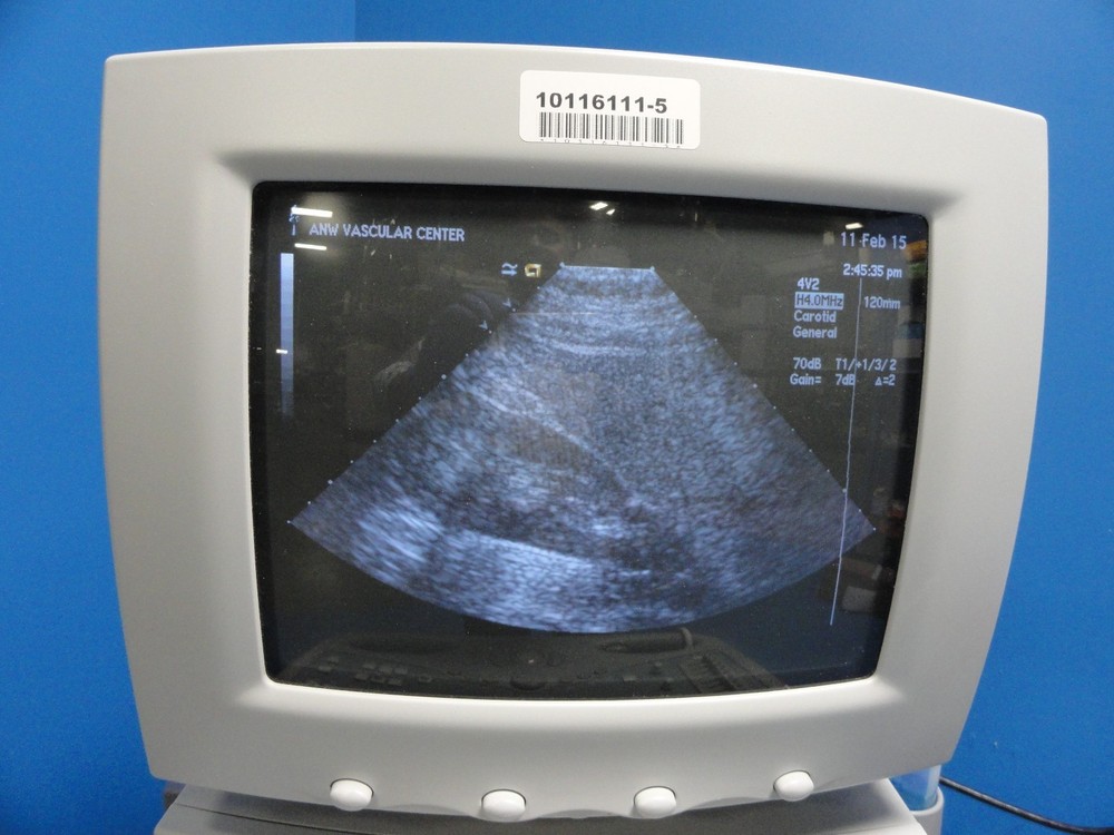 Siemens Acuson 4V2 Vector Array Ultrasound Probe – For Sequoia Series ~ 8588