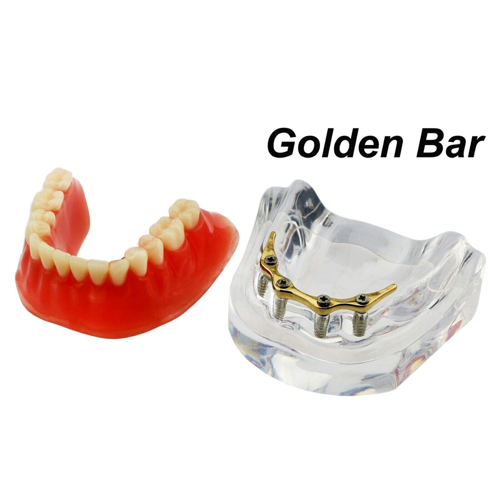 Dental Ortho Teeth Model Implants Practice Teaching Restortion Brushing Model