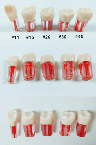 100pc Dental Root Canal Teeth Study Practice Model Endodontic RCT Endo Pulp File