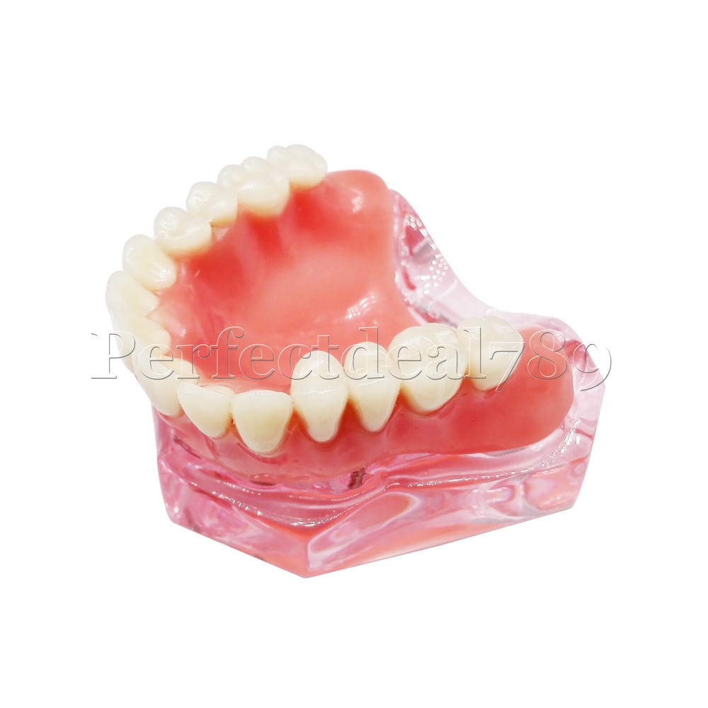 Dental Orthodontics Implant Study Model Analysis Demonstration Tooth Teaching