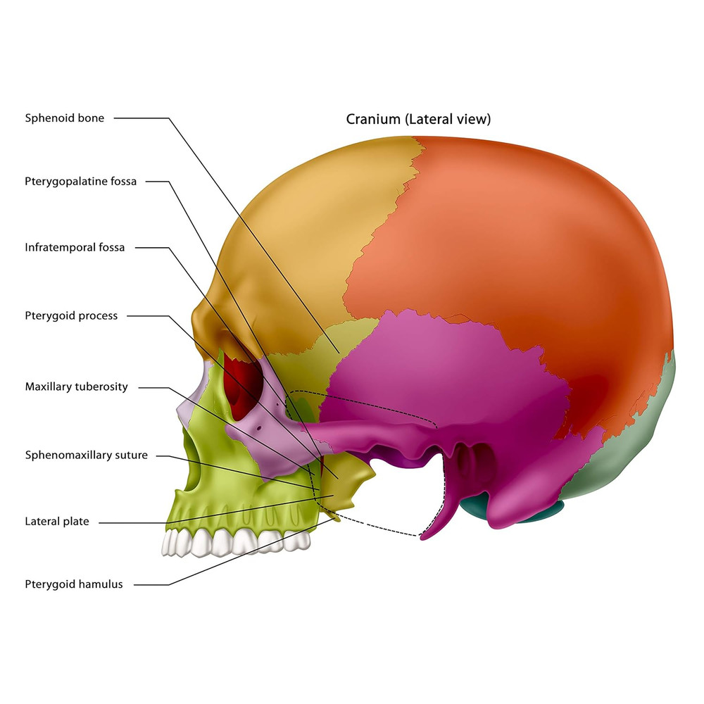 Pterygoid Implants: the Art and Science