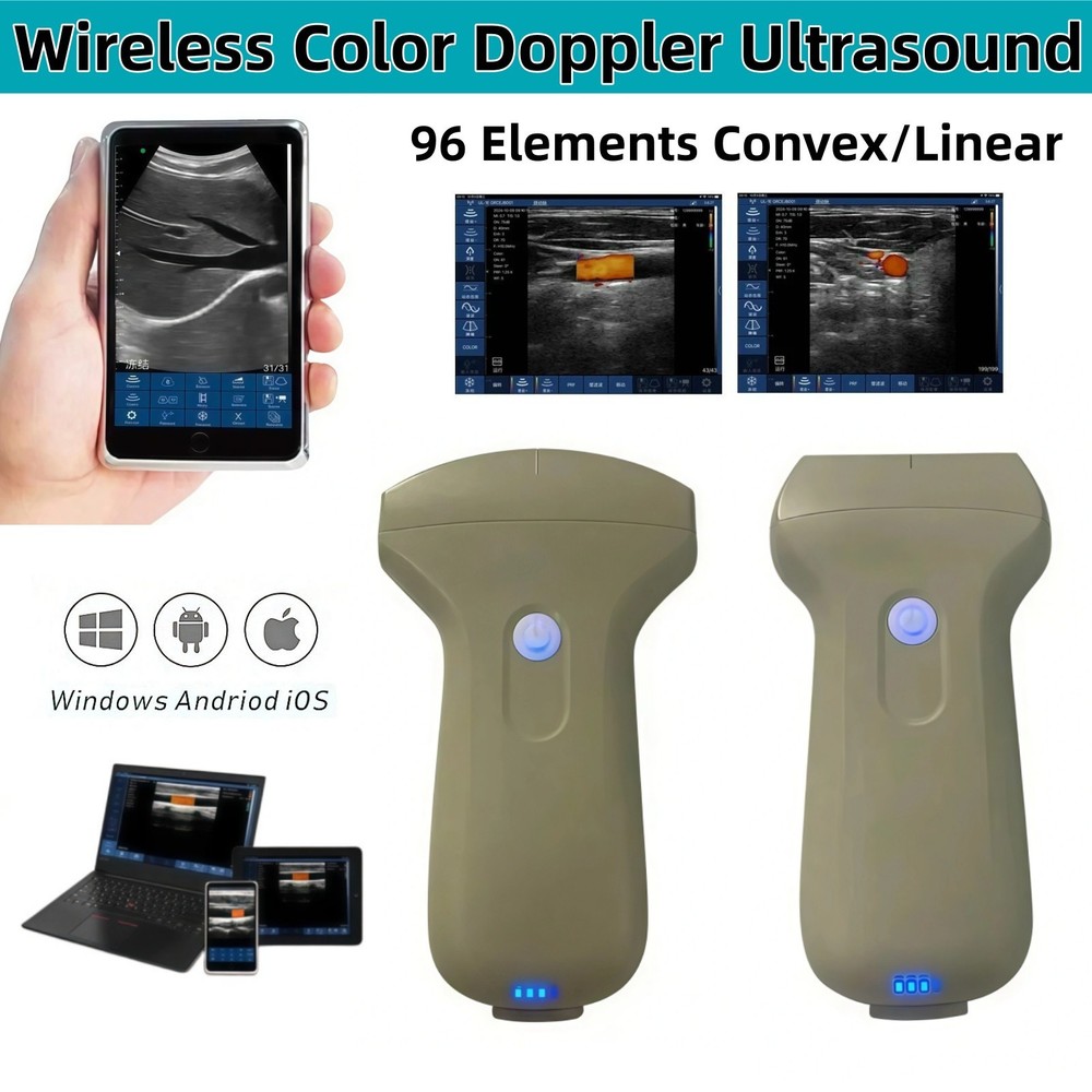 Portable 96 Elements Wireless Ultrasound Convex / Linear Handheld Color Doppler