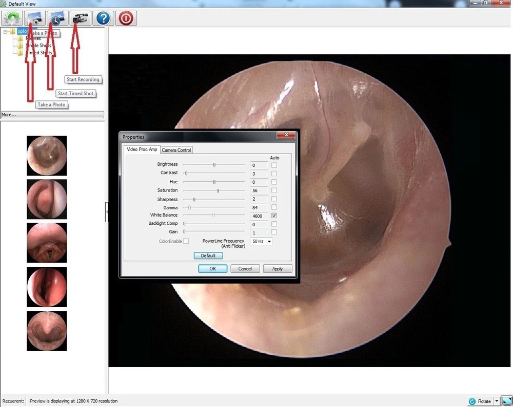 Rigid Endoscope Endoscopy for Dyonics HD USB Camera+Coupler+Light Source+Mount