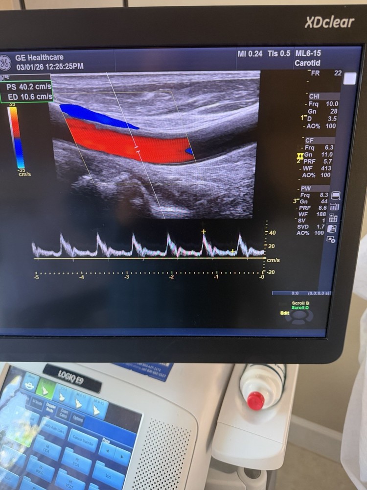GE  ML6-15 D  Linear Vascular Probe , Excellent working condition,