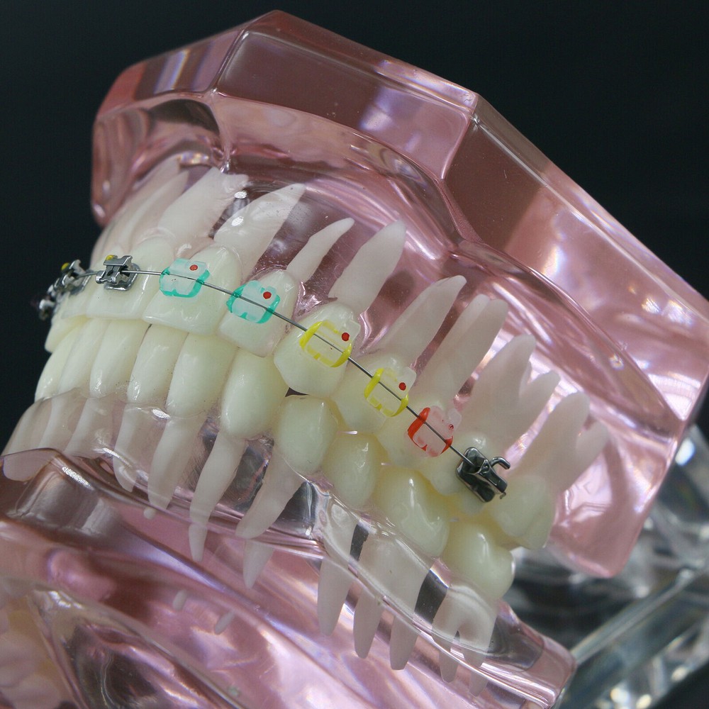 Dental Typodont Model Self-ligating Metal Bracket Ceramic Transparent Retainer