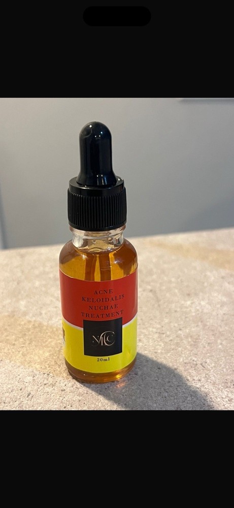 Acne Keloidalis Nuchae by NLC