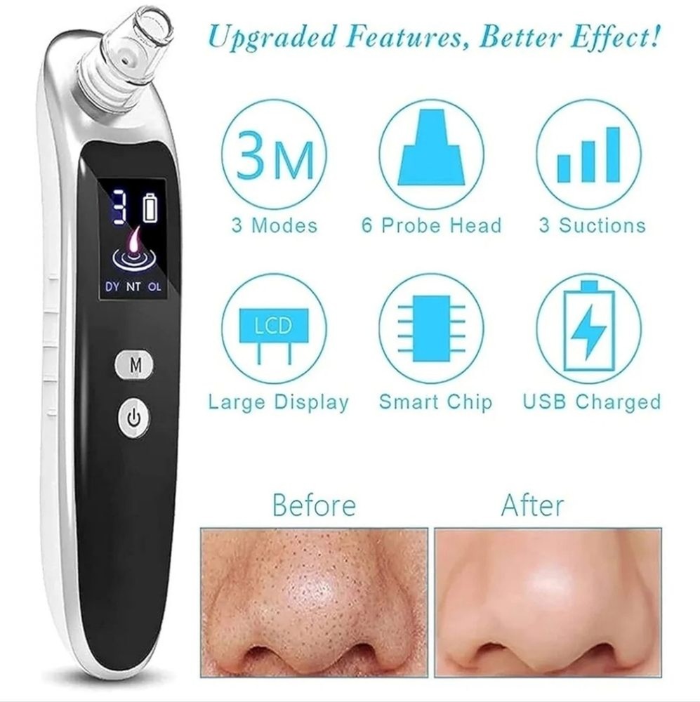 Advanced Blackhead Remover Vacuum - Black