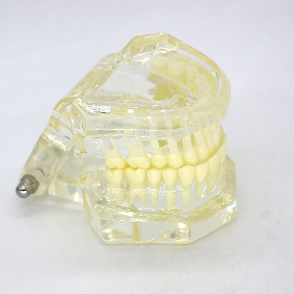 1×Transparent Plastic Study Teeth Model Demonstrate Comprehensive Repair Yellow