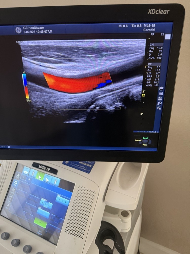 GE ML6-15 D Linear Vascular Probe , Excellent working condition,