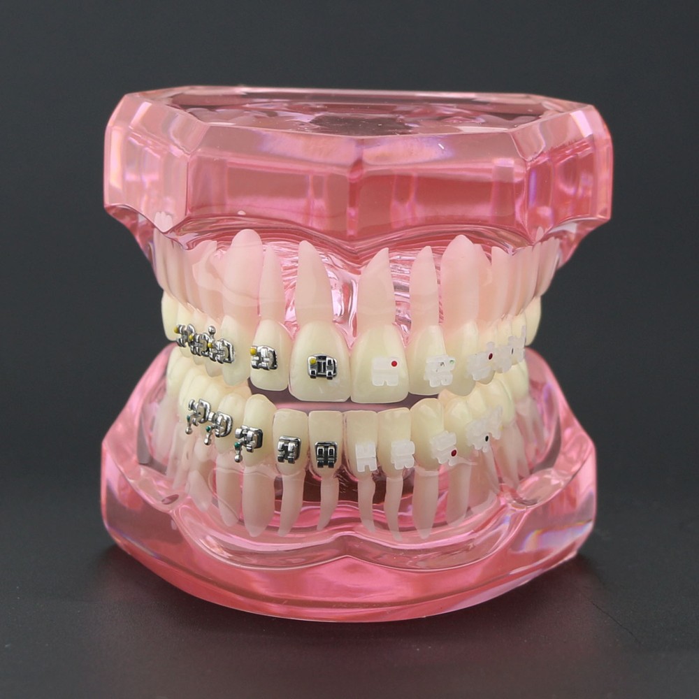 Dental Orthodontic Teeth Model Metal and Ceramic Bracket Study Teach Model 3003