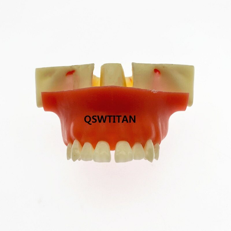 Dental Sinus Lift Practice Teeth / Tooth Model Simulation Typodont Study Model