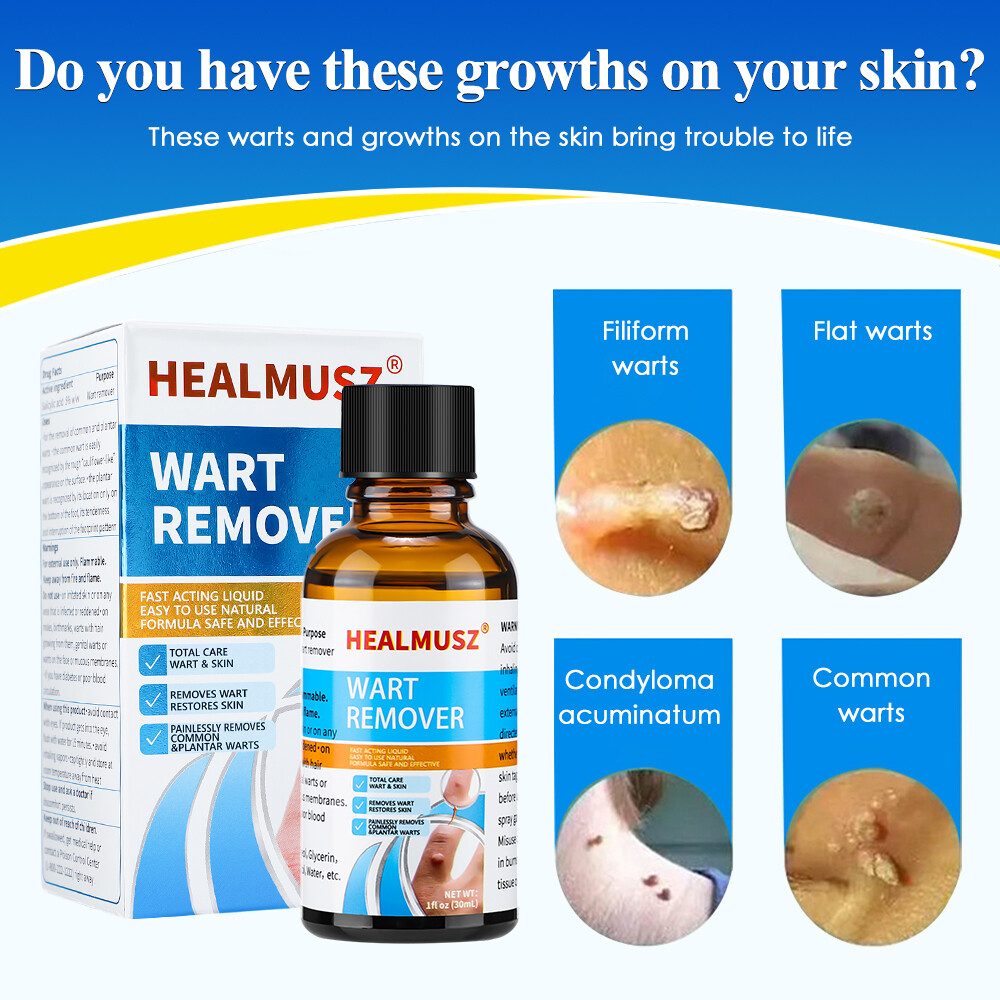 Wart Remover Liquid Skin Tag Mole Remover Eliminate Feet Corn Wart Remove Liquid