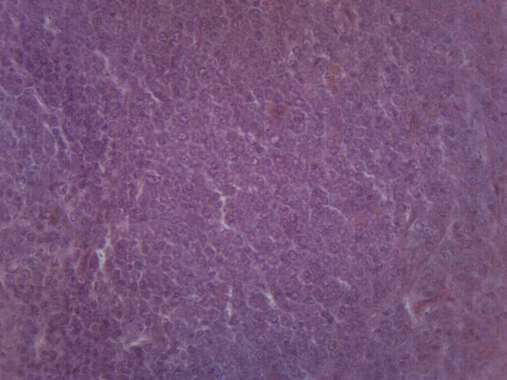Spleen Section - Prepared Microscope Slide - 75x25mm - Eisco Labs