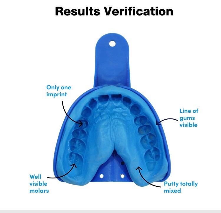 Glory smile teeth dental impression mold kit