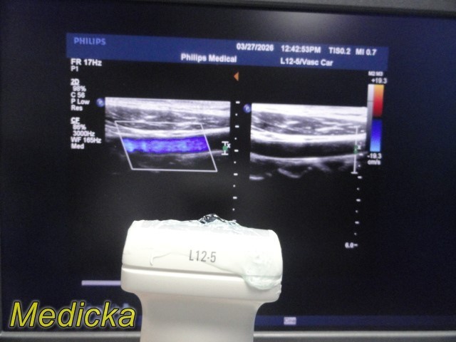 Philips L12-5 Linear Array Ultrasound Transducer *TESTED & WORKING* ~ 39679