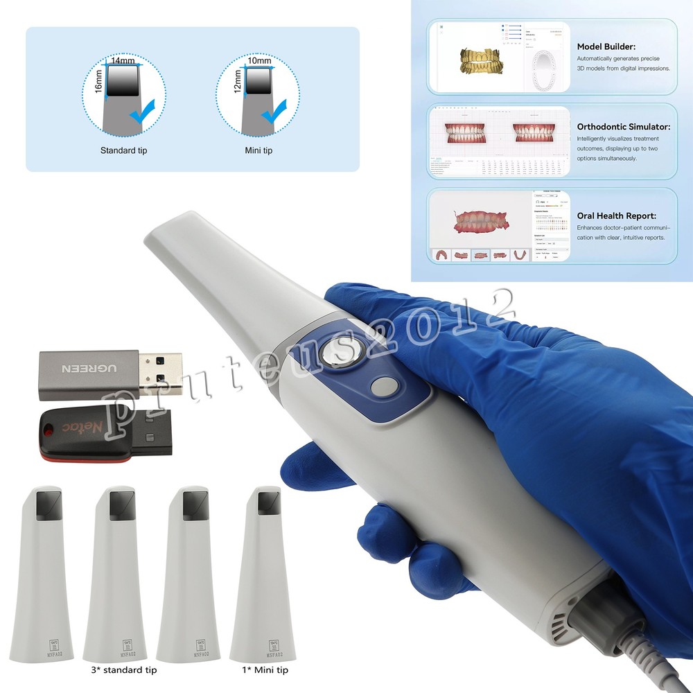 IntraOral Scanner - Digital Dental Solutions