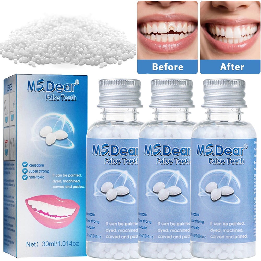 3X Tooth Repair Kit - Temporary Teeth Replacement Kit for Missing & Broken Teeth