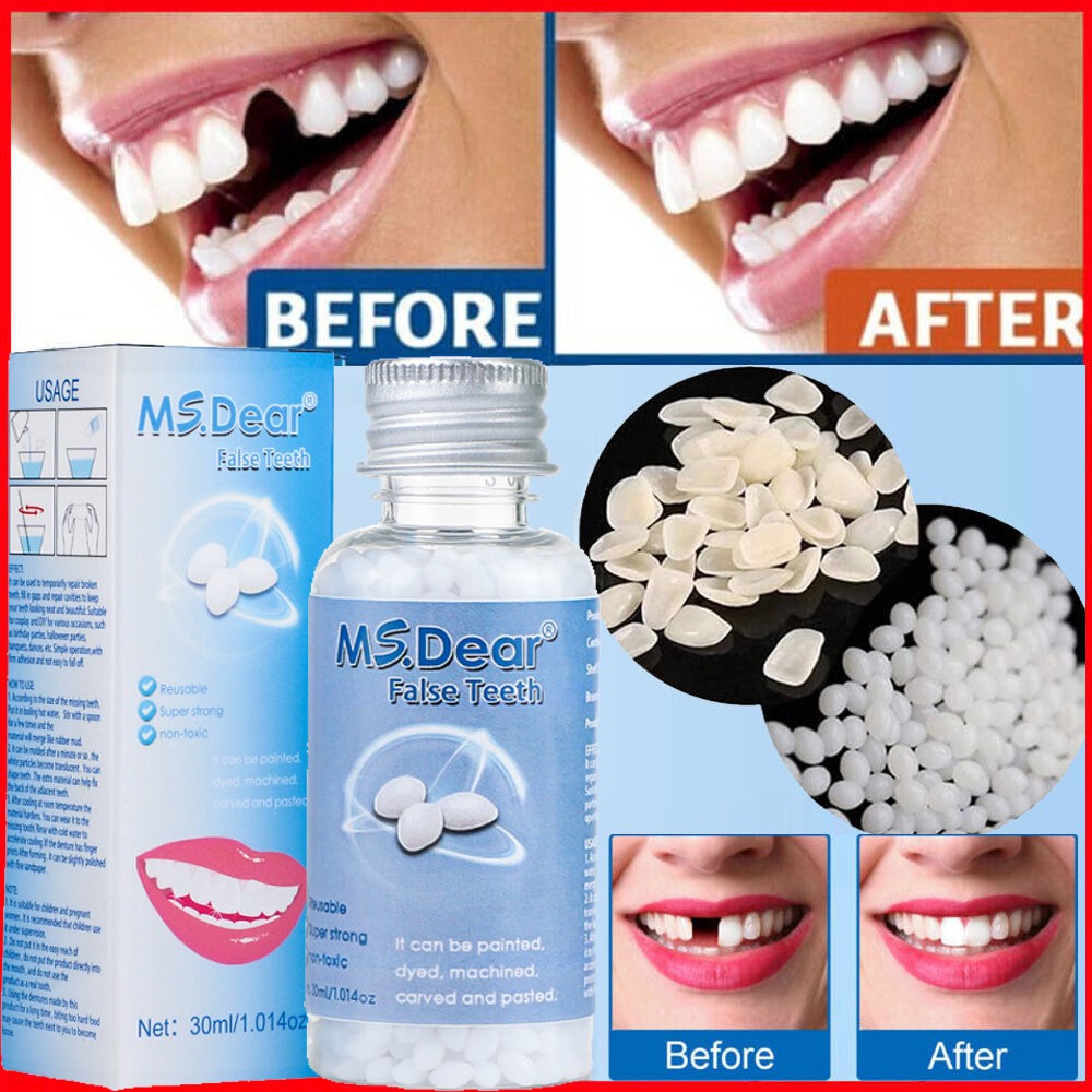 False Teeth Solid Glue Temporary Tooth Repair Moldable Fix Broke Gap Teeth 30ml
