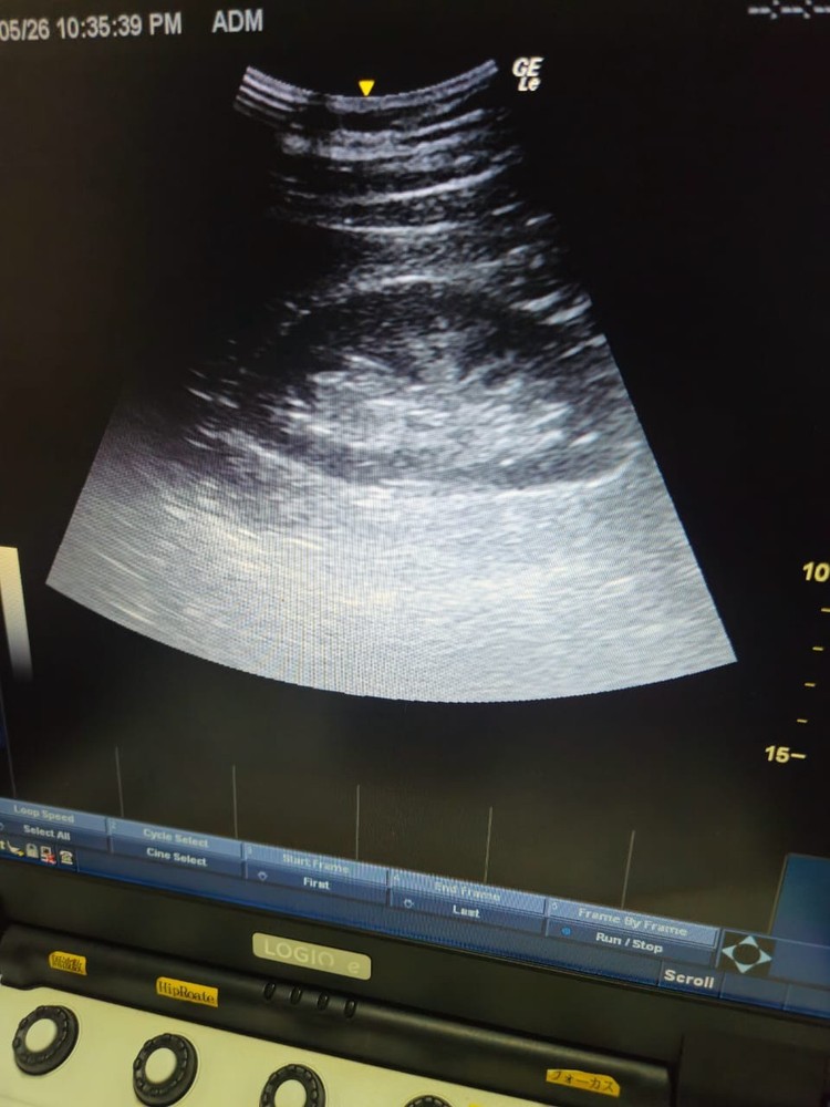 GE 4C-RS Convex Transducer with Shadow