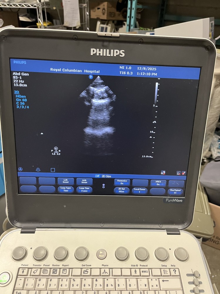 Philips CX50 Ultrasound Machine