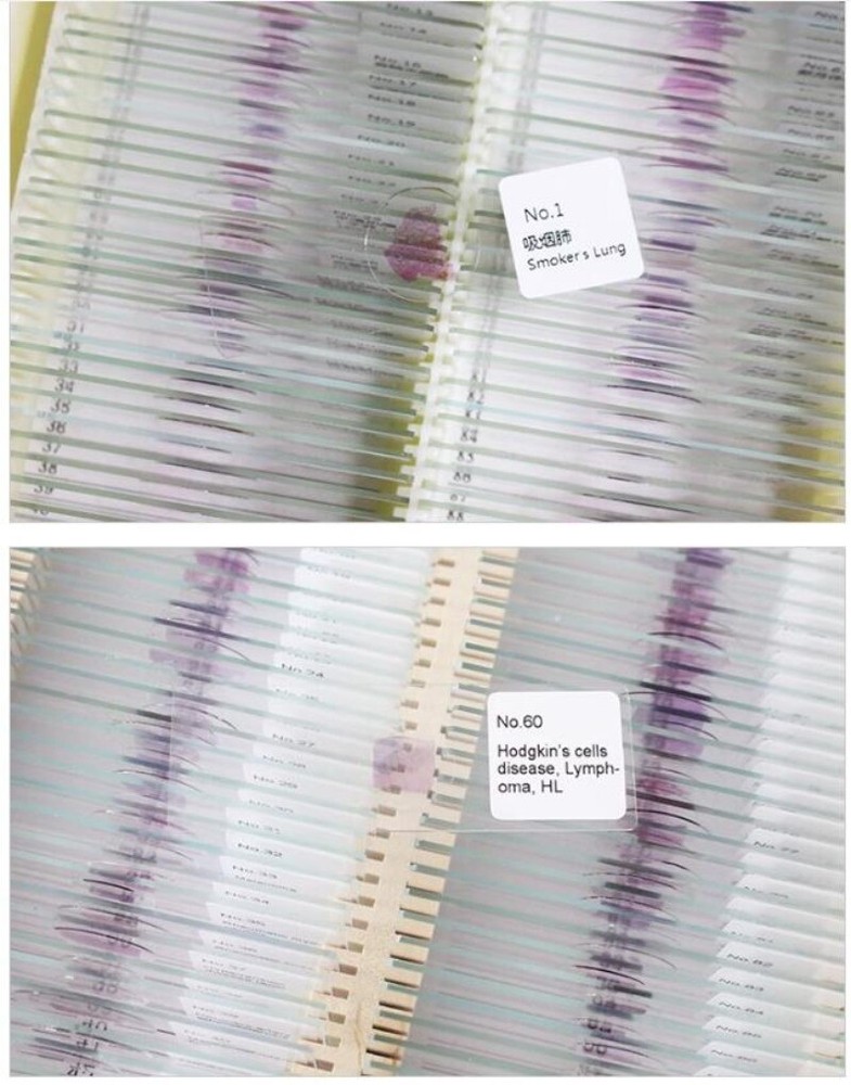 100PCS Mammal Pathological Section Typical Prepared Specimen Slides