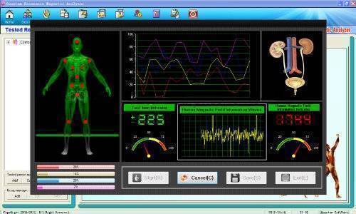 Newest Version Quantum Magnetic Resonance Body Analyzer English &Spanish Sofware