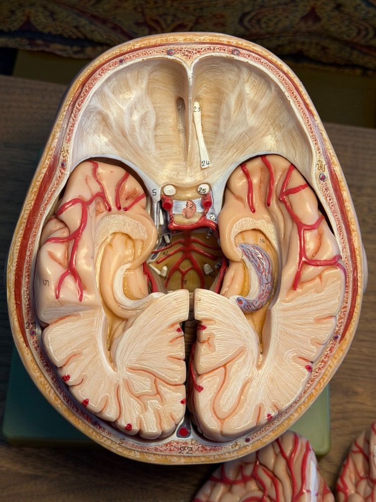 SOMSO Head, Brain, Cranial Nerves, Basilar Artery Model