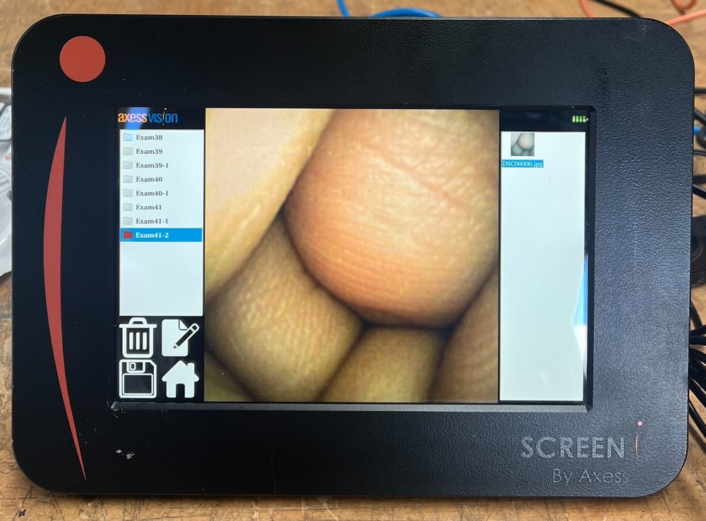 Axess Vision Viewing Solution REF 005.0008 with 3 Bronchoflex 005.0012