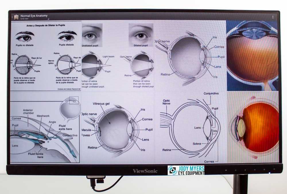 Lombart CVS Essential Vision Tester