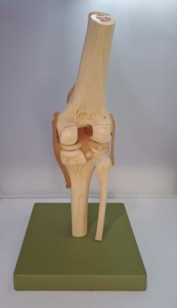 Vintage 1995 Somso Anatomical Model Functional Knee Joint Model BIN86