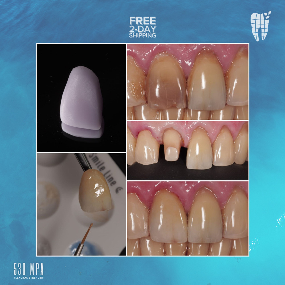 CEREC® Blocks Lithium Disilicate x5