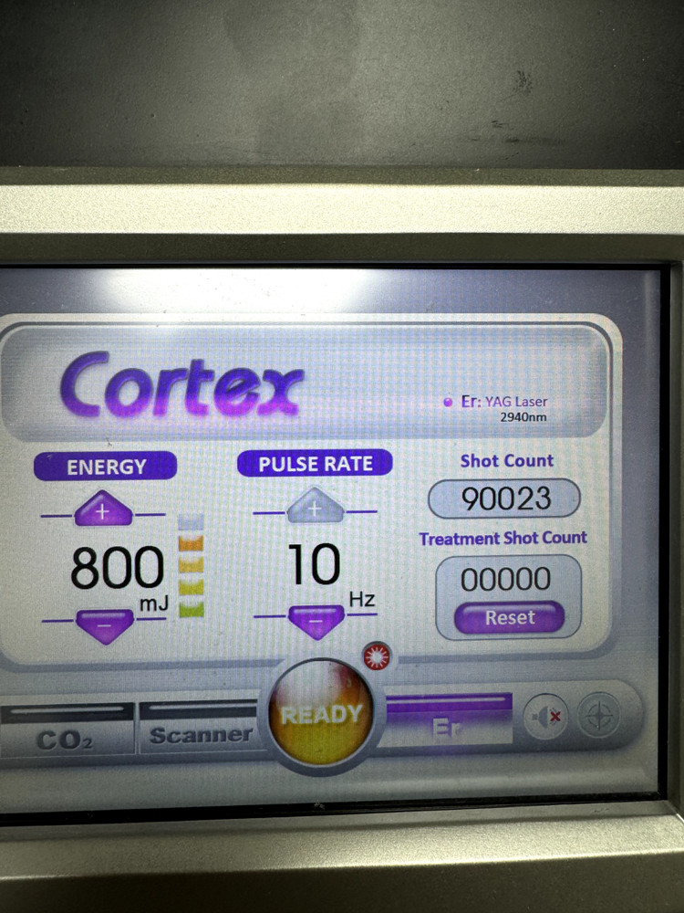 Sandstone Cortex Laser Co2 AND Erbium