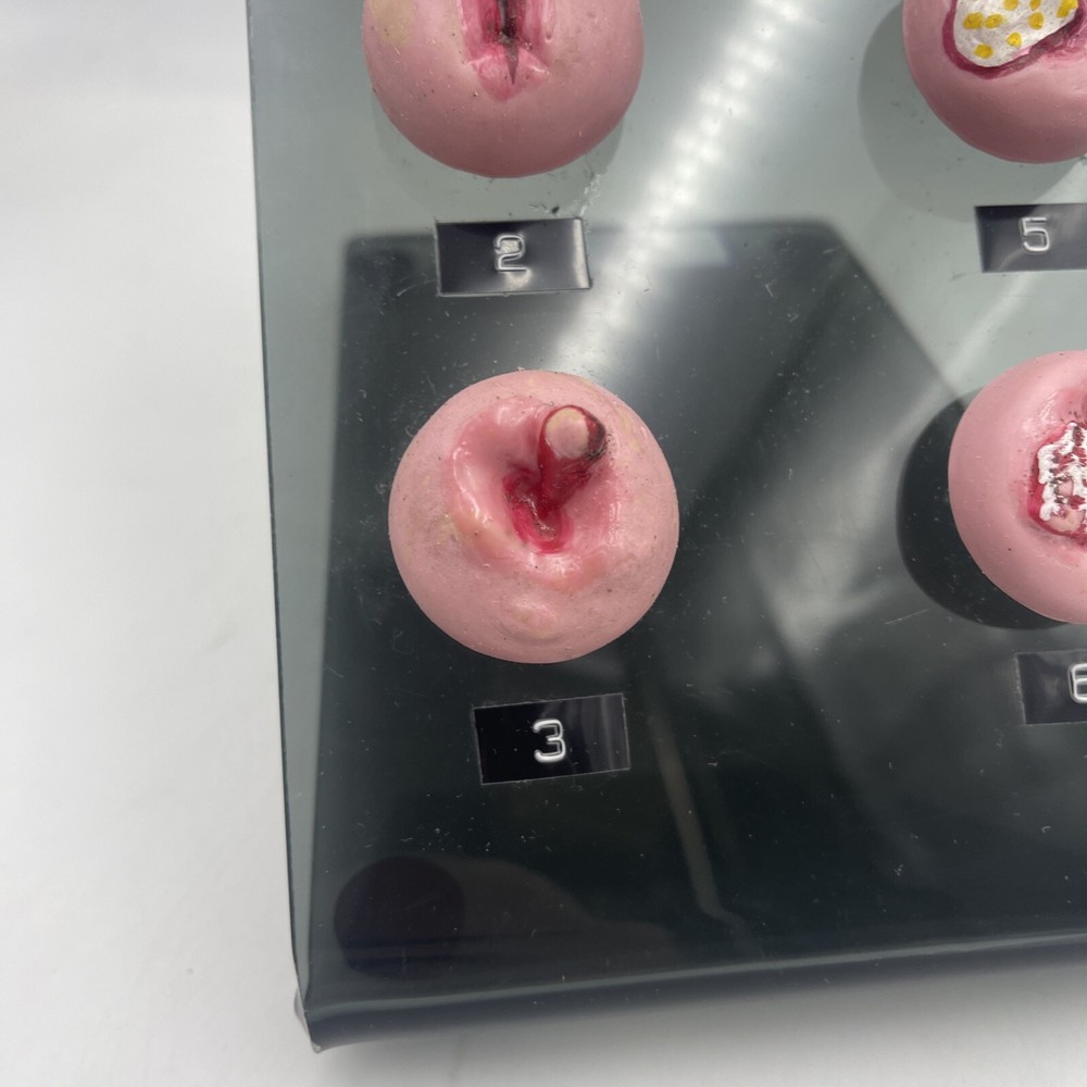 Gaumard S505 Cervical Pathologies Model Pathology Anatomical Ob/Gyn Cervix