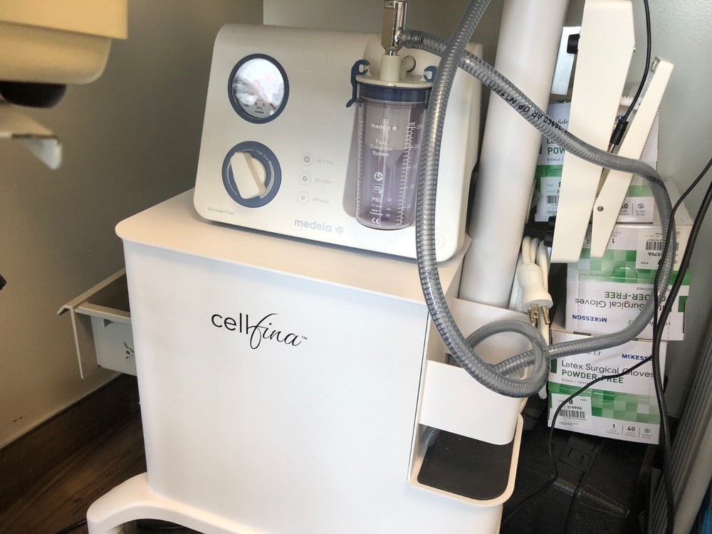cellfina cellulite reduction