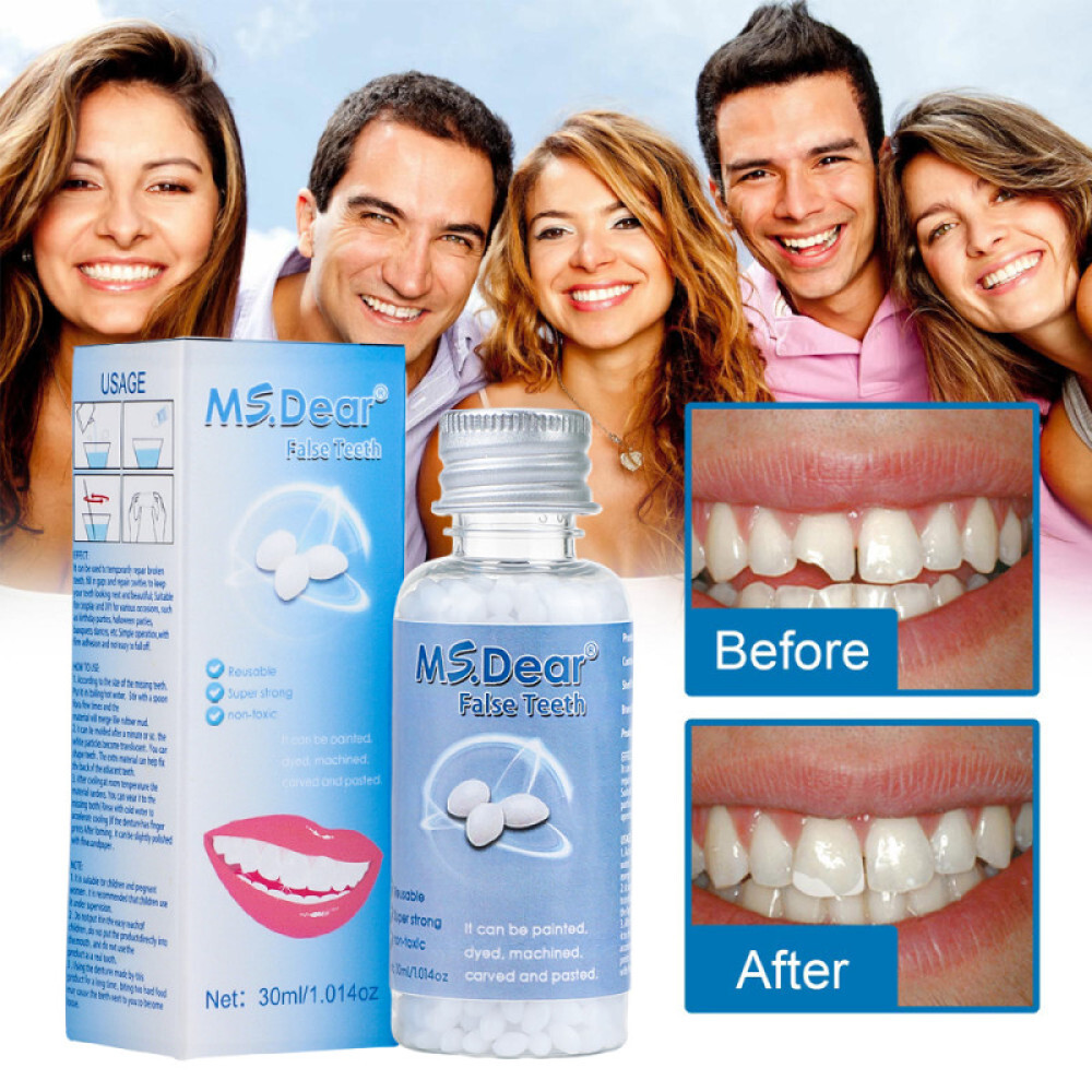 2Pcs Tooth Repair Kit Temporary Teeth Replacement Kit for Missing & Broken Teeth