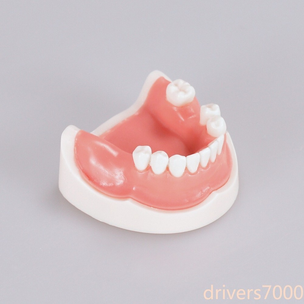 Dental Teeth Missing Implanting Typodont Training Dentistry Model Display
