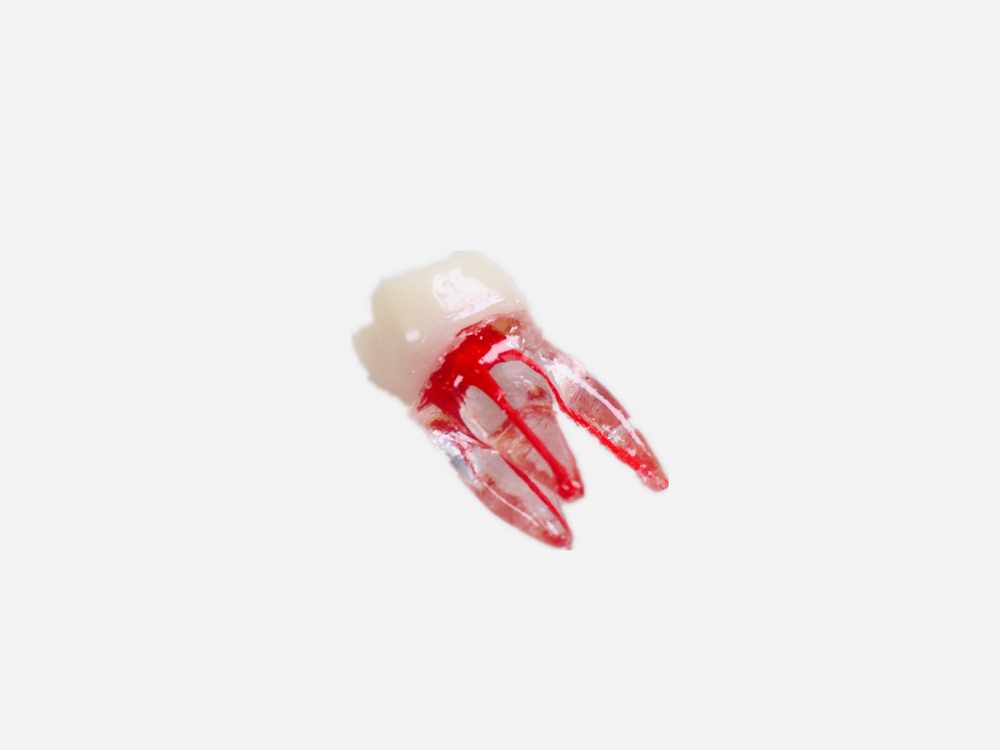 Dental Tooth Endo Root Canal Study Model For RCT Practice Blocks Pulp Cavity