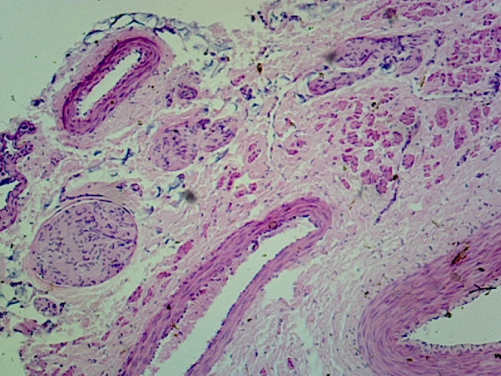 Medium-Sized Artery and Vein, Human; Cross Section