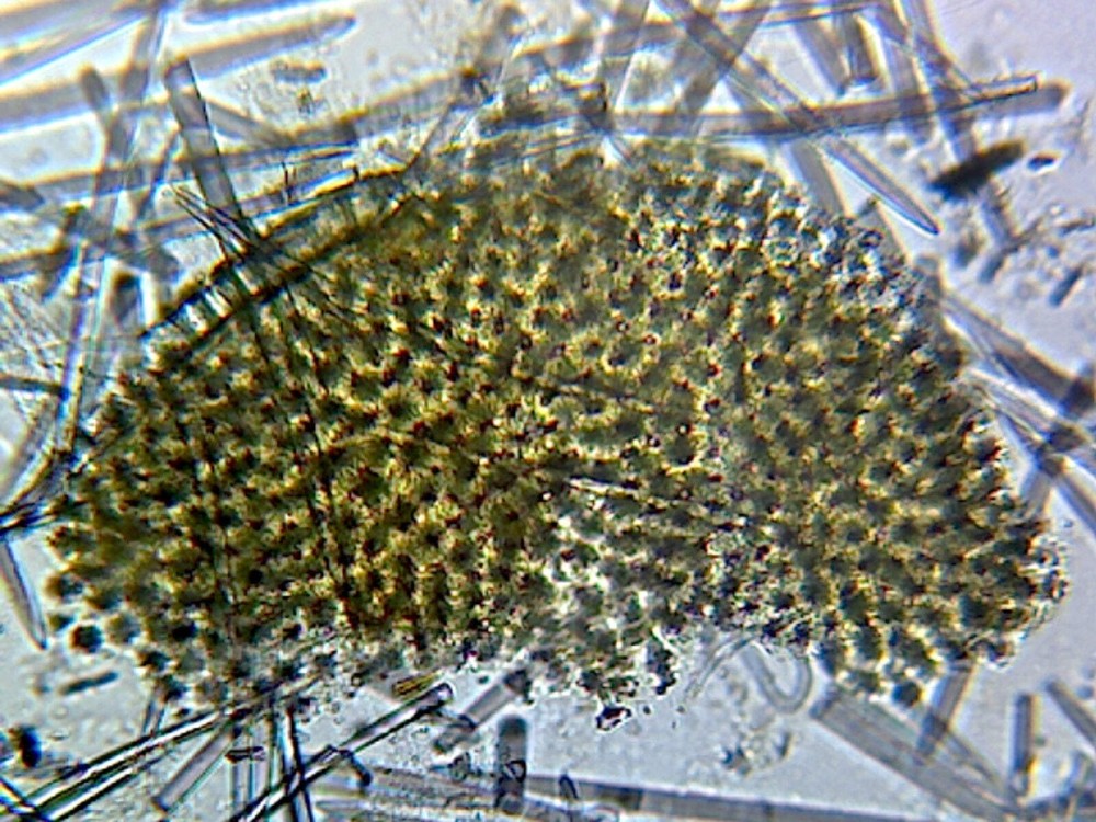 Mixed Spicules; Whole-mount