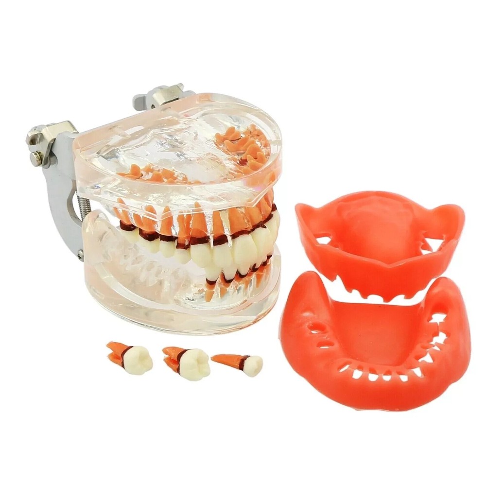 Dental Teeth Model Pathological Disease M4017 Removable Teaching Study Model