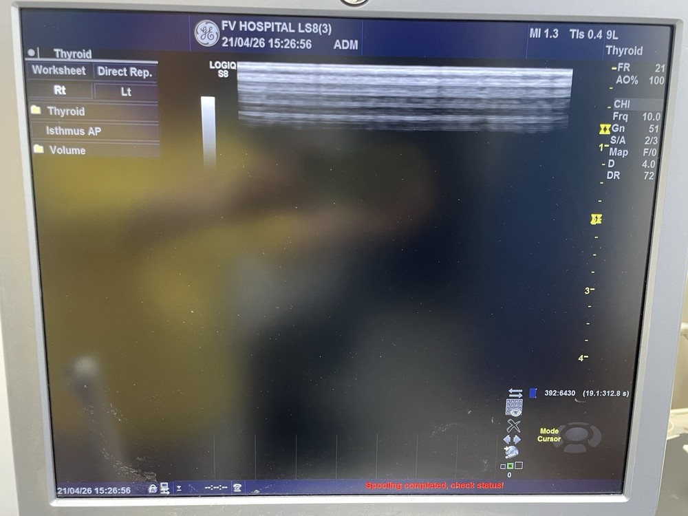 Ge ultrasound probe Linear 9L-D