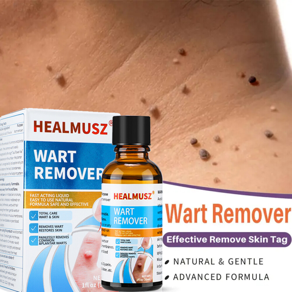 Wart Remover Liquid Skin Tag Mole Remover Eliminate Feet Corn Wart Remove Liquid